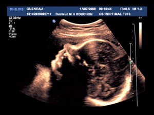 Mini Gueneau - 30 weeks