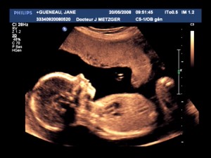 Mini Gueneau - 22 weeks Mini Gueneau - 22 weeks